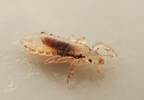 OTC Head Lice Treatments May Be Losing Effectiveness OTC Head Lice Treatments May Be Losing Effectiveness
