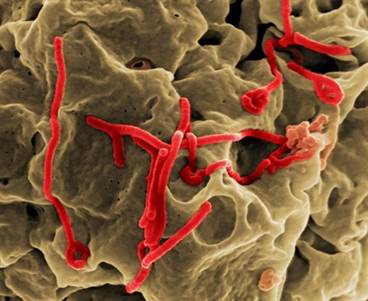 New Ebola Vaccine Highly Effective in Preventing Spread of Disease New Ebola Vaccine Highly Effective in Preventing Spread of Disease