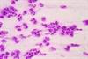 Mortality in CAP Following Sepsis Clinical Criteria Update Mortality in CAP Following Sepsis Clinical Criteria Update