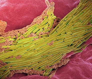 Review of Clostridium difficile Vaccines in Development Review of Clostridium difficile Vaccines in Development
