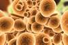 <i>Candida auris</i>: Dispatch From an Outbreak <i>Candida auris</i>: Dispatch From an Outbreak