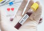 HIV Testing Insufficient in Young MSM HIV Testing Insufficient in Young MSM