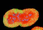 Last-Resort Gonorrhea Treatment Sees Resistance in 66% of Countries Last-Resort Gonorrhea Treatment Sees Resistance in 66% of Countries