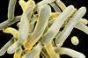 Mortality in MDR TB Decreases With Directly Observed Therapy Mortality in MDR TB Decreases With Directly Observed Therapy