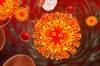 Better Diagnostics Needed for Milder Neurocognitive Disorders Linked to HIV Better Diagnostics Needed for Milder Neurocognitive Disorders Linked to HIV