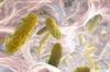Challenges in Managing Hospital-Acquired Pneumonia Challenges in Managing Hospital-Acquired Pneumonia