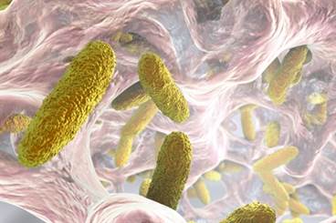 Challenges in Managing Hospital-Acquired Pneumonia Challenges in Managing Hospital-Acquired Pneumonia