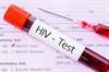 CDC: No Evidence to Encourage More Frequent HIV Screening in MSM CDC: No Evidence to Encourage More Frequent HIV Screening in MSM