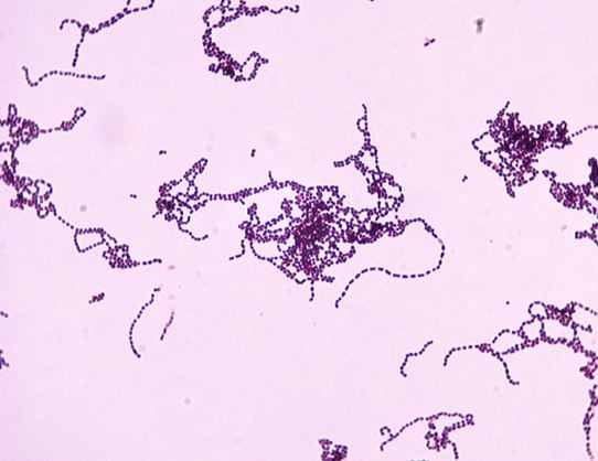 Streptocococcus Pyogenes
