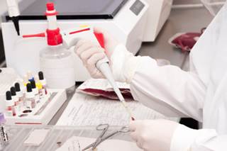 The test can be used to screen organ donors for the two major types of HIV (HIV-1 and HIV-2), but it's not been approved to routinely screen donated blood or plasma for the virus. The test can be used to screen organ donors for the two major types of HIV (HIV-1 and HIV-2), but it's not been approved to routinely screen donated blood or plasma for the virus.