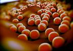 Community-Acquired Staph Bacteremia More Common in Diabetes Patients? Community-Acquired Staph Bacteremia More Common in Diabetes Patients?