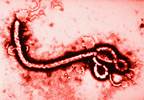 Ebola Survivor Discusses Ongoing Sequelae and Lessons Learned for Future Outbreaks Ebola Survivor Discusses Ongoing Sequelae and Lessons Learned for Future Outbreaks
