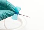 Chlorhexidine-Alcohol Found Superior Over Povidone Iodine-Alcohol In Preventing Short-Term Catheter Infections Chlorhexidine-Alcohol Found Superior Over Povidone Iodine-Alcohol In Preventing Short-Term Catheter Infections