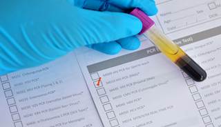 Routine HIV testing is both cost-effective and cost saving compared to the alternatives. Routine HIV testing is both cost-effective and cost saving compared to the alternatives.