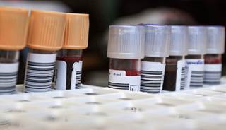 HIV self-testing promotion through apps has a high potential to reach untested high-risk populations. HIV self-testing promotion through apps has a high potential to reach untested high-risk populations.