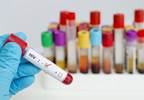 AIDS 2016: Global Fight Against HIV Remains Challenging AIDS 2016: Global Fight Against HIV Remains Challenging