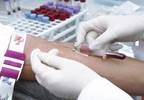 Case of Acquired Syphilis Leads to Bone Marrow and Liver Involvement Case of Acquired Syphilis Leads to Bone Marrow and Liver Involvement