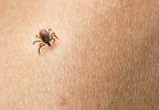 CDC Officials Update Diagnosis, Treatment Guidelines for Severe Tickborne Illnesses CDC Officials Update Diagnosis, Treatment Guidelines for Severe Tickborne Illnesses