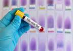 Two Patients With Polio Reported in Nigeria Two Patients With Polio Reported in Nigeria