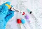 Age Likely a Factor in Pelvic Inflammatory Cases Caused by Chlamydia Age Likely a Factor in Pelvic Inflammatory Cases Caused by Chlamydia