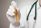 Onsite Tests Have High Specificity for Finding Asymptomatic Bacteriuria Onsite Tests Have High Specificity for Finding Asymptomatic Bacteriuria