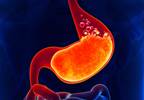 Both Concomitant, Sequential Treatment Effective as First-line Therapy for H pylori Both Concomitant, Sequential Treatment Effective as First-line Therapy for H pylori