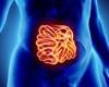 Microbiota Disruption Associated With Antibiotics Increased Risk for Sepsis Microbiota Disruption Associated With Antibiotics Increased Risk for Sepsis