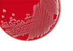 Whole Genome Sequencing Data May Help Track Antibiotic Resistance Patterns Whole Genome Sequencing Data May Help Track Antibiotic Resistance Patterns