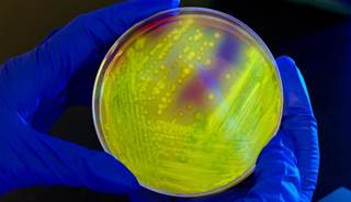 New treatment strategies are necessary as researchers work to prevent <i>C difficile</i> infection. <i>Photo credit: James Gathany/CDC PHIL</i> New treatment strategies are necessary as researchers work to prevent <i>C difficile</i> infection. <i>Photo credit: James Gathany/CDC PHIL</i>