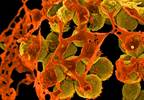 Increasing Incidence of Staphylococcal Scalded Skin Syndrome in the United States Increasing Incidence of Staphylococcal Scalded Skin Syndrome in the United States