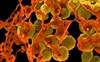 Increasing Incidence of Staphylococcal Scalded Skin Syndrome in the United States Increasing Incidence of Staphylococcal Scalded Skin Syndrome in the United States