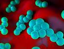 Call for New Infection Diagnosis Criteria in Emergency Department Call for New Infection Diagnosis Criteria in Emergency Department