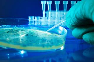 Responsible use of antibiotics in the community, healthcare settings, and in food animal production is key to controlling the spread of resistance. Responsible use of antibiotics in the community, healthcare settings, and in food animal production is key to controlling the spread of resistance.