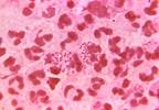 New Assay Targets Susceptibility to Ciprofloxacin in Gonorrhea New Assay Targets Susceptibility to Ciprofloxacin in Gonorrhea