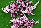 Ribaxamase May Prevent Opportunistic Infections During IV β-lactam Treatment Ribaxamase May Prevent Opportunistic Infections During IV β-lactam Treatment
