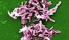 Bezlotoxumab Reduces 30-Day Hospital Readmissions for <I>C difficile</I> Infection Bezlotoxumab Reduces 30-Day Hospital Readmissions for <I>C difficile</I> Infection