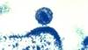 Influence of Vitamin D in HIV Infection Influence of Vitamin D in HIV Infection