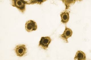Prevymis inhibits viral replication through targeting the viral terminase complex. <i>Photo Credit: CDC/Sylvia Whitfield.</i> Prevymis inhibits viral replication through targeting the viral terminase complex. <i>Photo Credit: CDC/Sylvia Whitfield.</i>