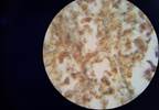 STD Rates Hit Unprecedented High in US STD Rates Hit Unprecedented High in US