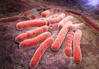 Latent Tuberculosis May Benefit From 3-Month Rifapentine, Isoniazid Tx Latent Tuberculosis May Benefit From 3-Month Rifapentine, Isoniazid Tx