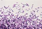 IDSA/SHEA Publish Updated C difficile Infection Clinical Guidelines IDSA/SHEA Publish Updated C difficile Infection Clinical Guidelines