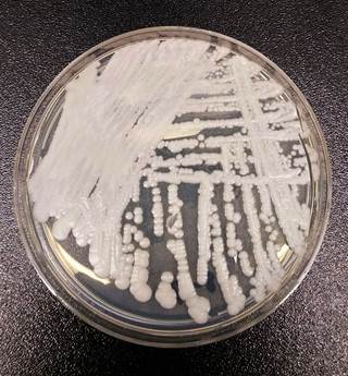 A strain of <i>Candida auris</i> <i>Photo Credit: Shawn Lockhart</i> A strain of <i>Candida auris</i> <i>Photo Credit: Shawn Lockhart</i>