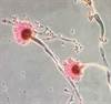 Voriconazole-Resistant Invasive Aspergillosis Associated With Higher Mortality Voriconazole-Resistant Invasive Aspergillosis Associated With Higher Mortality
