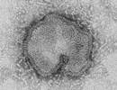 Pandemic Possible With H7N9 Avian Influenza Variant Pandemic Possible With H7N9 Avian Influenza Variant