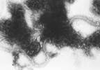 Disease Course Slightly Worse With Acute Bacterial LRTI Disease Course Slightly Worse With Acute Bacterial LRTI