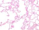 Respiratory Effects of Cannabis: a National Academies Report Respiratory Effects of Cannabis: a National Academies Report