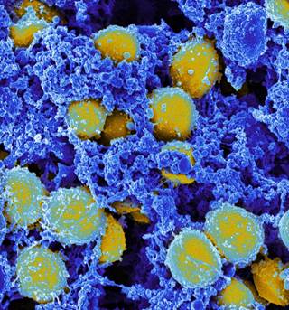 Hog workers in the North Carolina developing skin infections from multidrug-resistant <i>S aureus</i>. <i>Photo Credit: National Institute of Allergy and Infectious Diseases (NIAID)</i> Hog workers in the North Carolina developing skin infections from multidrug-resistant <i>S aureus</i>. <i>Photo Credit: National Institute of Allergy and Infectious Diseases (NIAID)</i>