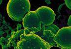 VA: MRSA Infection Rates on the Decline VA: MRSA Infection Rates on the Decline