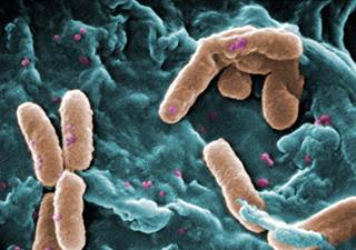 Two phase 3 trials (ORBIT-3 and ORBIT-4) yielded promising results for Pulmaquin (inhaled ciprofloxacin). <i>Photo Credit: CDC/ Janice Haney Carr.</i> Two phase 3 trials (ORBIT-3 and ORBIT-4) yielded promising results for Pulmaquin (inhaled ciprofloxacin). <i>Photo Credit: CDC/ Janice Haney Carr.</i>