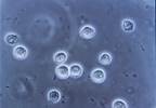 Zemdri Now Available for the Treatment of Complicated UTI, Pyelonephritis Zemdri Now Available for the Treatment of Complicated UTI, Pyelonephritis